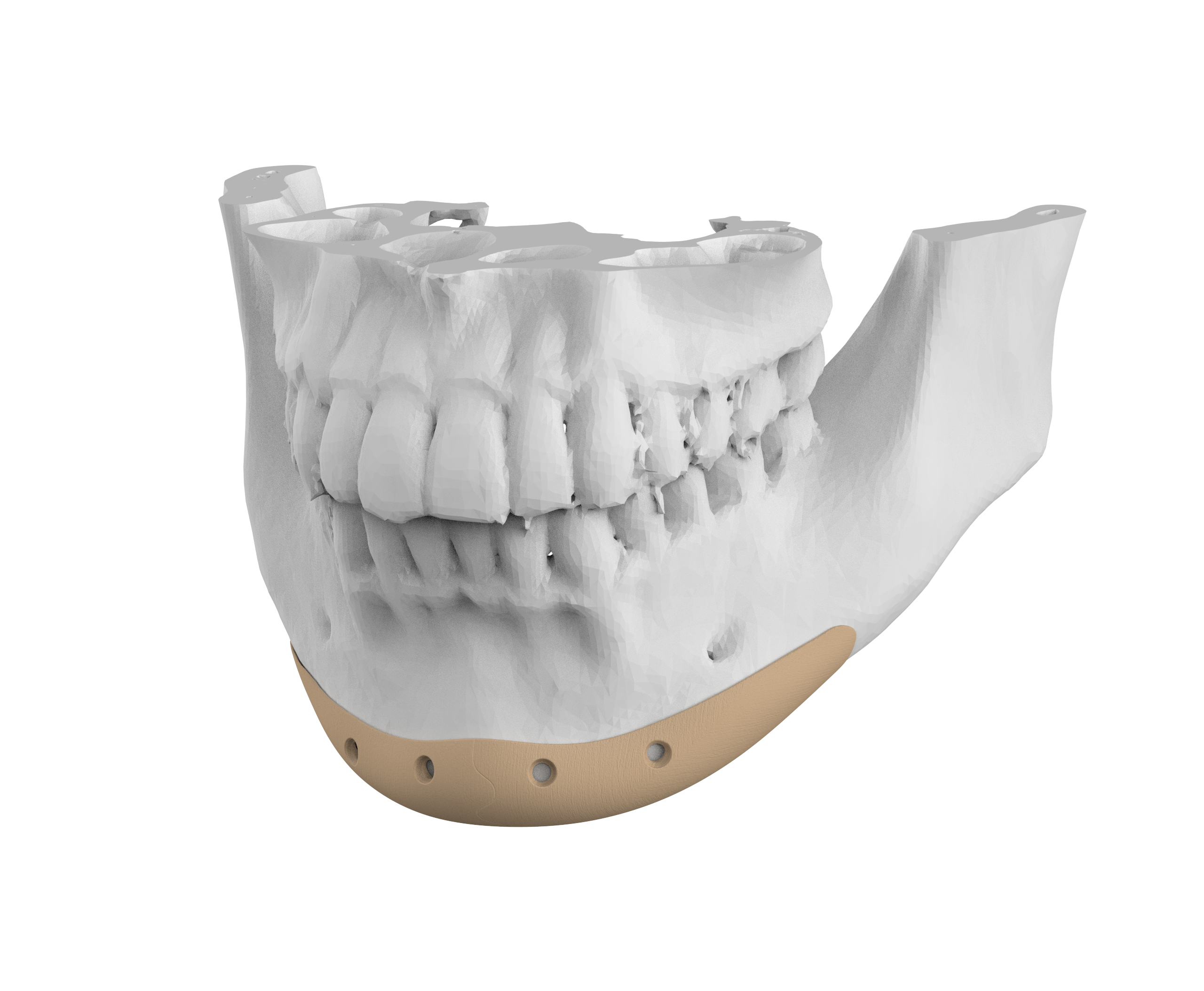 Mandible detail 1