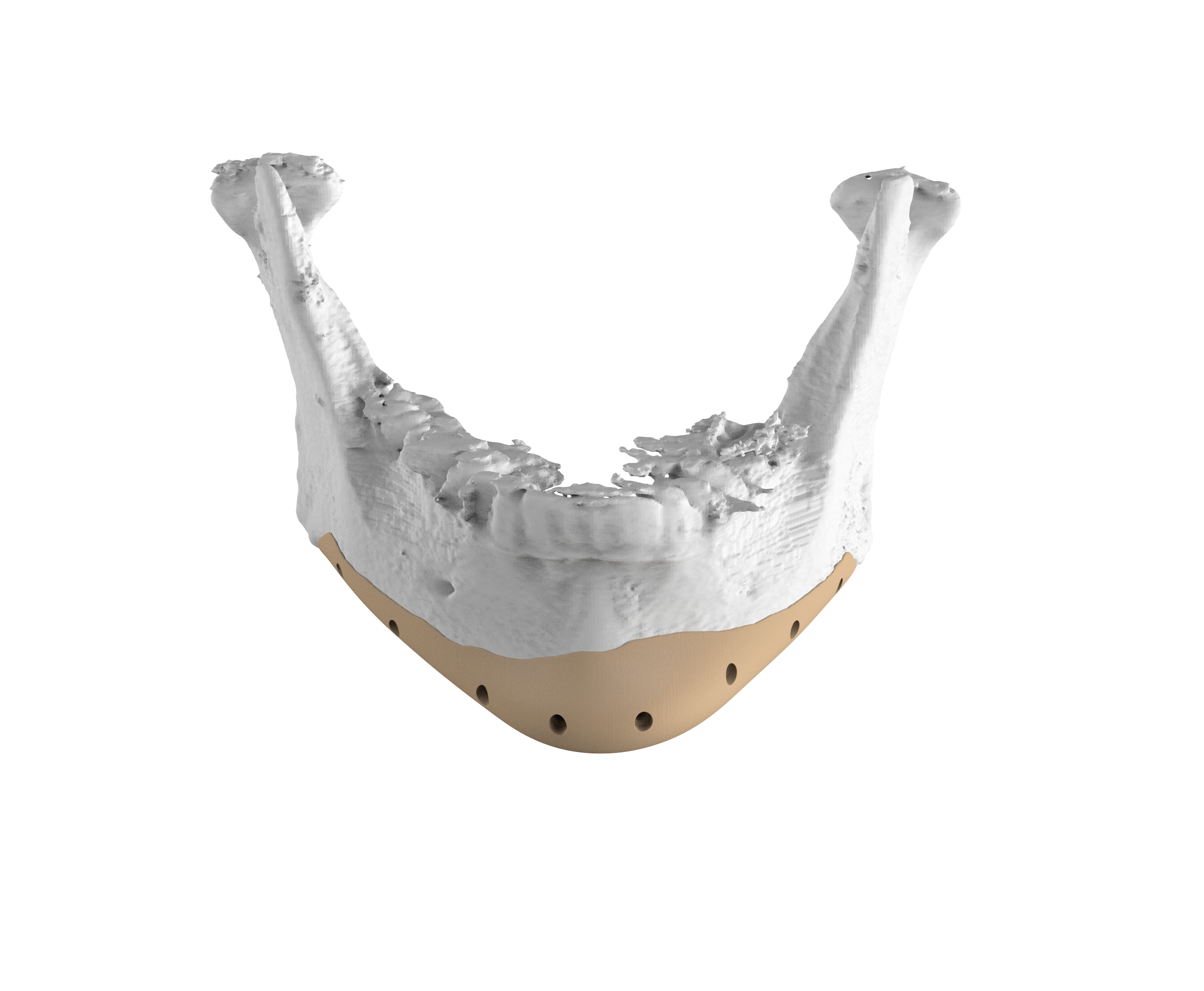 Mandible detail 2