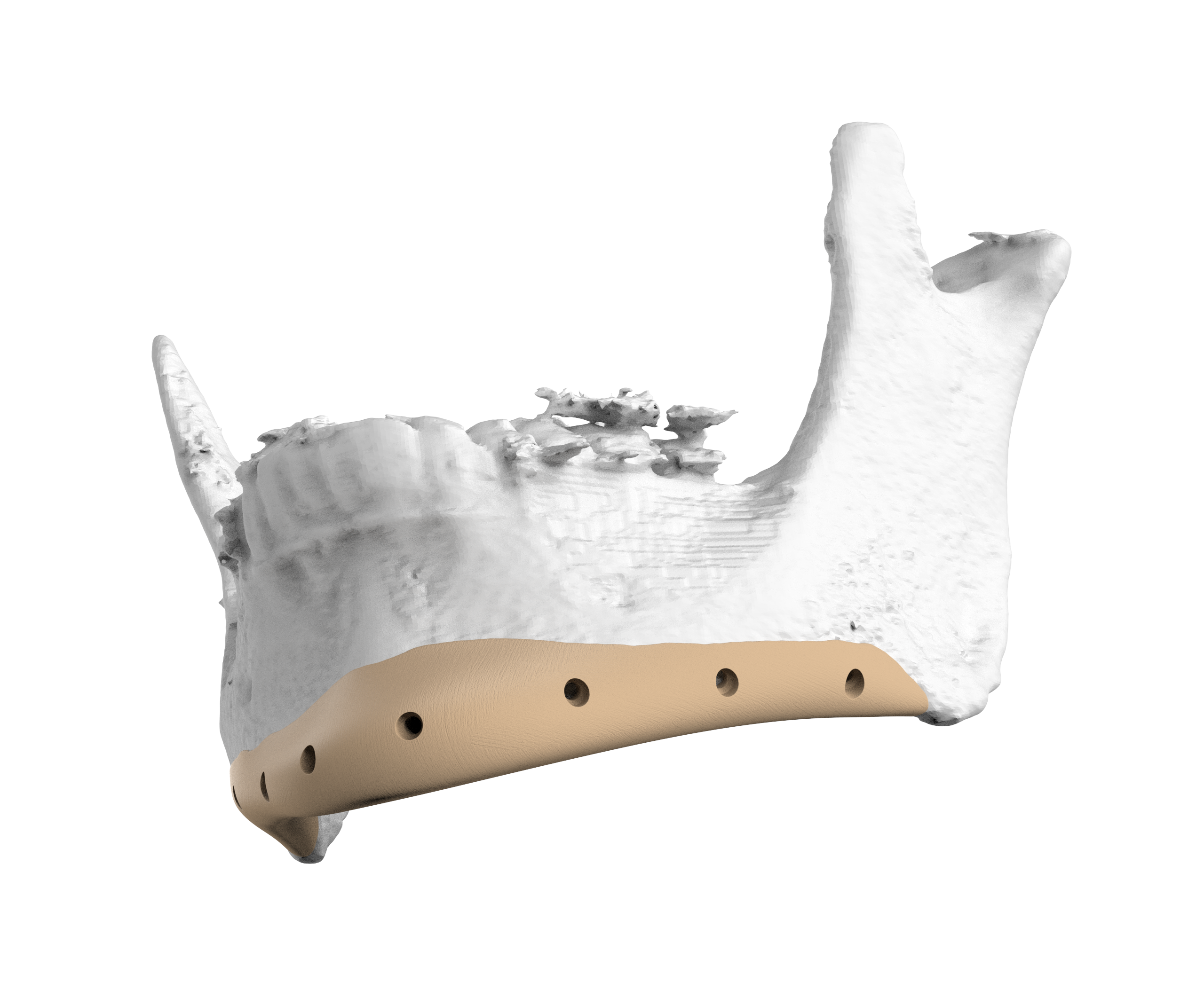 Mandible detail 3