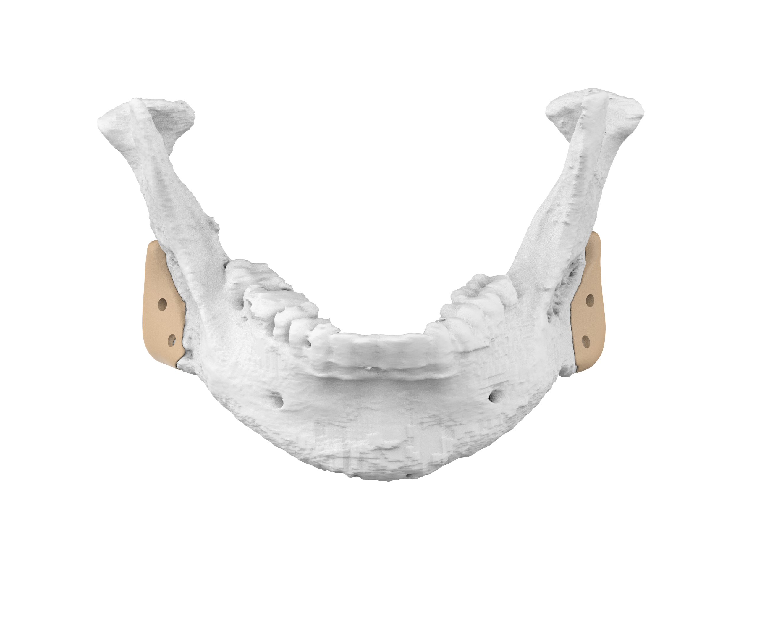 Mandible detail 4